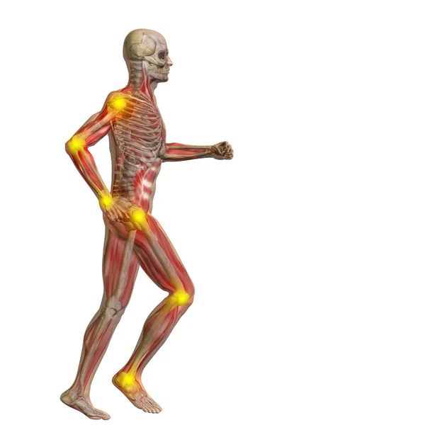 Human with  joints pain — Stock Photo, Image