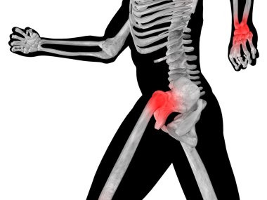 joint or articular pain, ache clipart