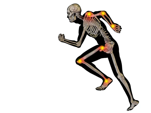 Human with  joints pain — Stock Photo, Image