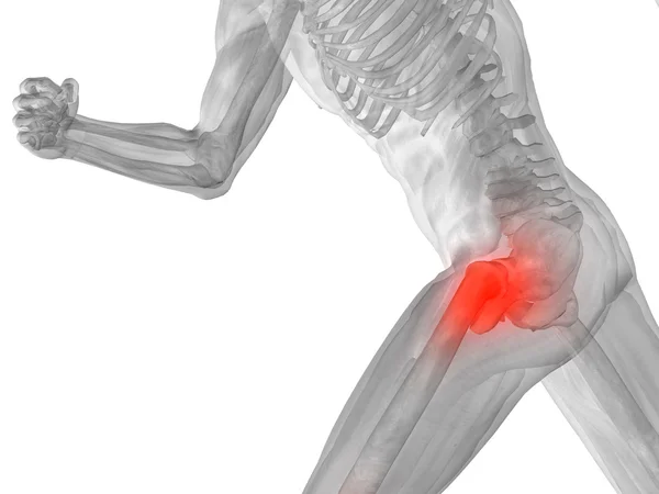 ortak veya eklem ağrısı, ağrı