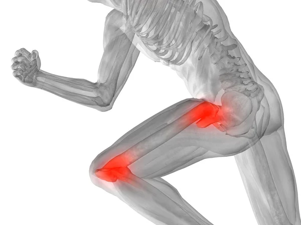 eklem veya eklem ağrısı, ağrı