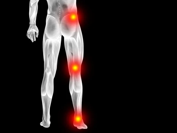 Joint or articular pain, ache — Stock Photo, Image