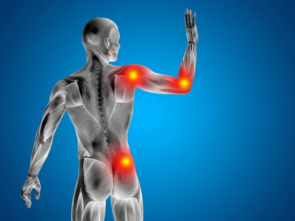 Human with  joints pain — Stock Photo, Image