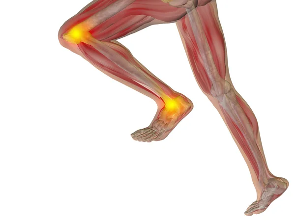Joint or articular pain, ache — Stock Photo, Image