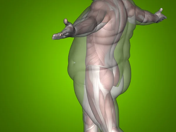 Übergewicht gegen schlanke Figur — Stockfoto