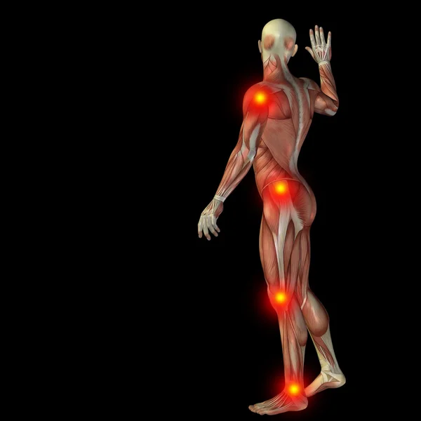 Man med muskler för anatomi med smärta — Stockfoto