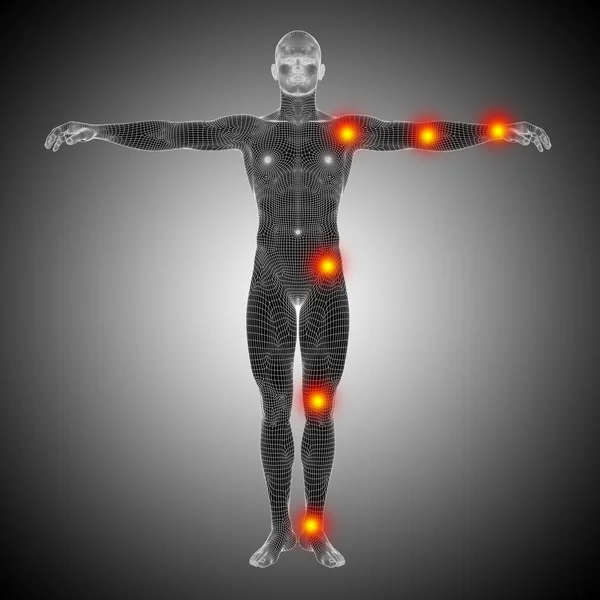 Ihmisen anatomia mesh tai langallinen runko kehon kipua — kuvapankkivalokuva