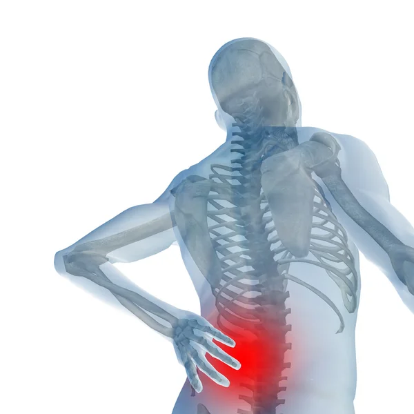Concettuale 3d umano con mal di schiena — Foto Stock