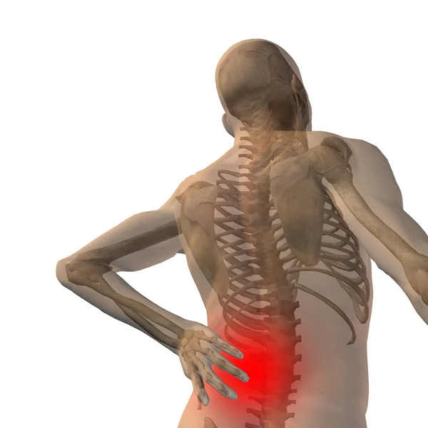 Man  with back pain — Stock Photo, Image