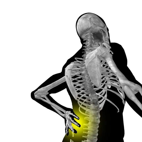 背痛人解剖 — 图库照片
