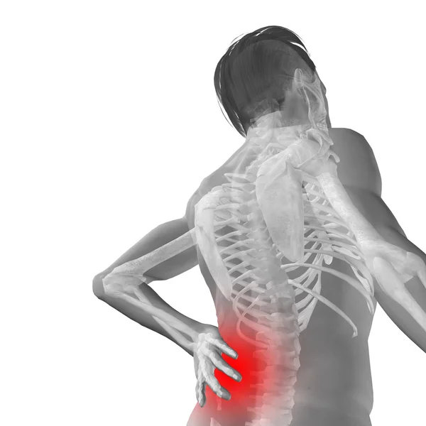 Humano conceptual con dolor de espalda — Foto de Stock