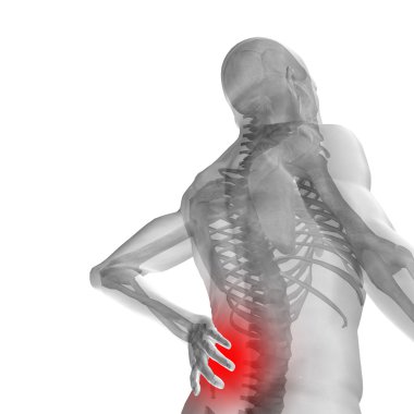 adam anatomisi arka ağrı ile