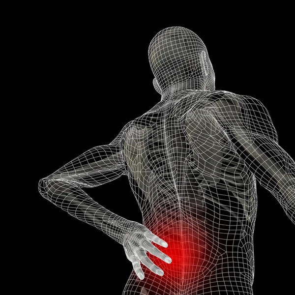 osteoporose symptomen pijn