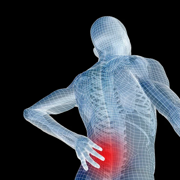Anatomia dell'uomo con mal di schiena — Foto Stock