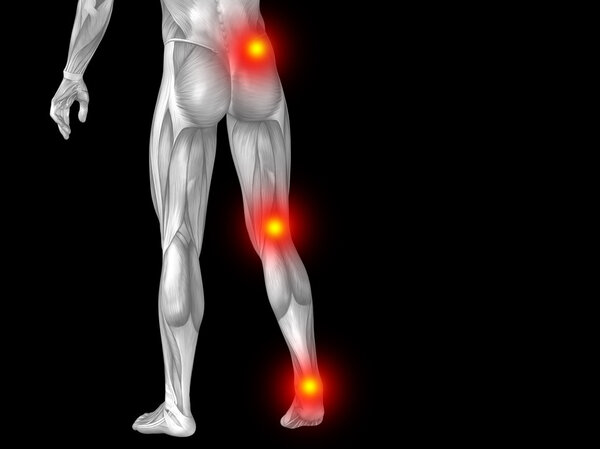 Joint or articular pain