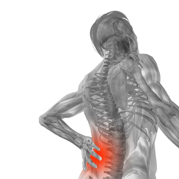 Анатомія людини з болем у спині — стокове фото