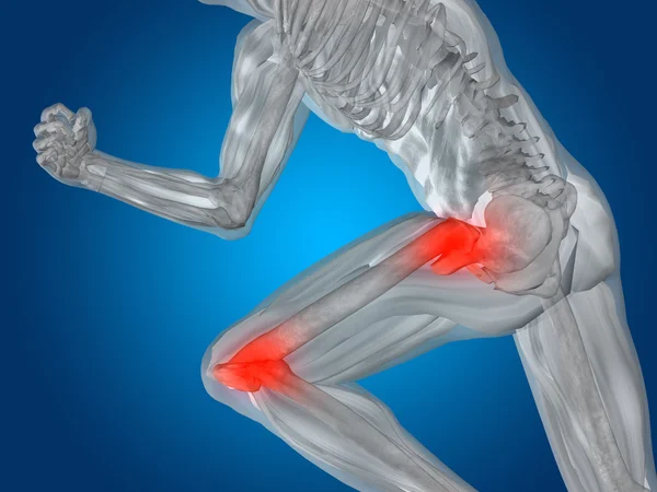 Joint or articular pain — Stock Photo, Image