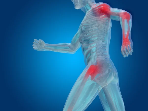 Joint or articular pain — Stock Photo, Image