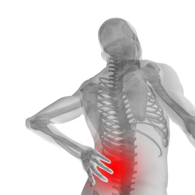 adam anatomisi arka ağrı ile