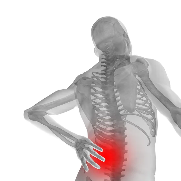 Man anatomy with back pain — Stock Photo, Image