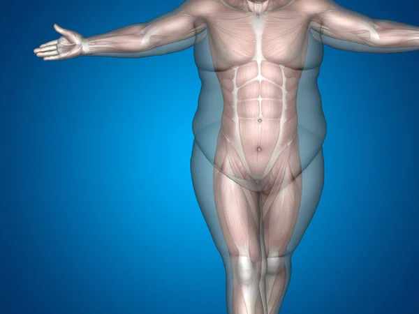 3D-vet overgewicht vs slanke passen dieet — Stockfoto