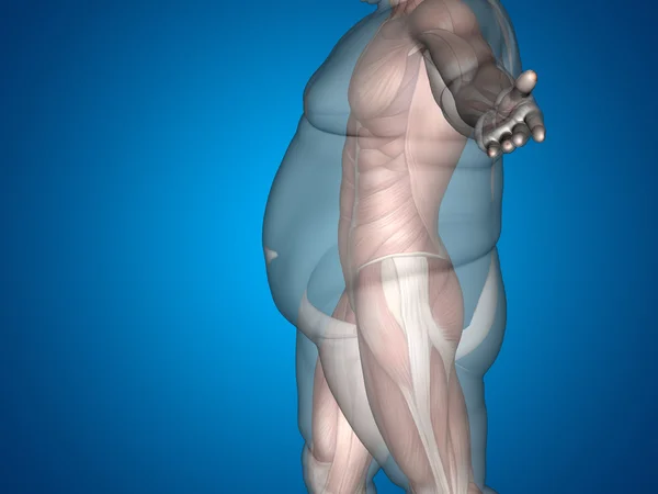 3D Διατροφή λίπους υπέρβαροι vs slim ταιριάζει — Φωτογραφία Αρχείου