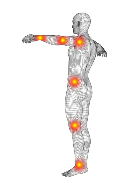 Anatomía humana con dolor —  Fotos de Stock