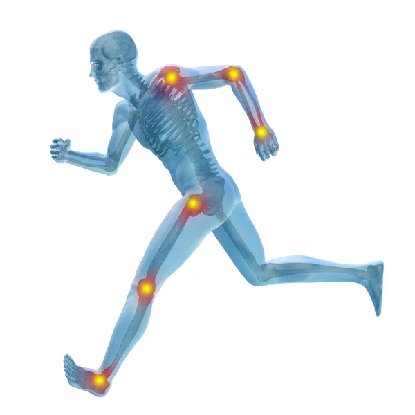 ortak veya eklem ağrısı, ağrı