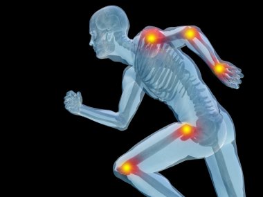 oint or articular pain