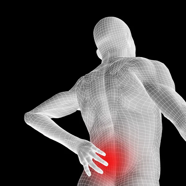 Anatomia com dor nas costas — Fotografia de Stock