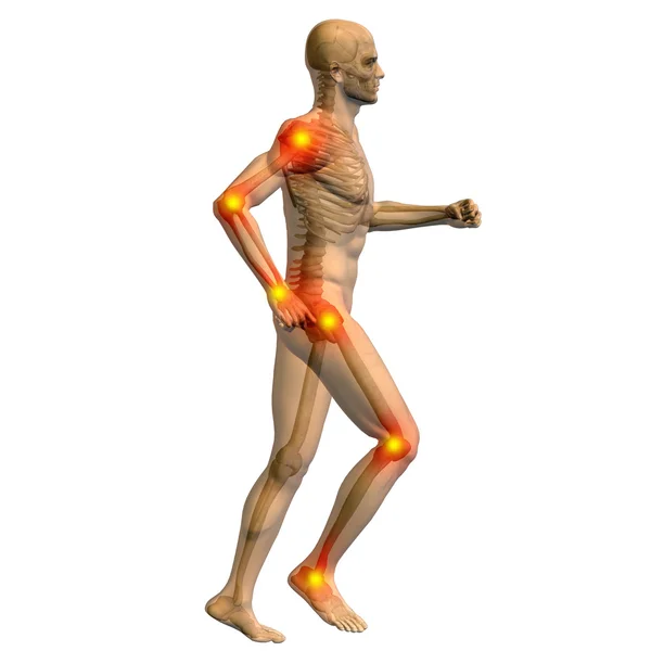 Joint or articular pain, ache — Stock Photo, Image