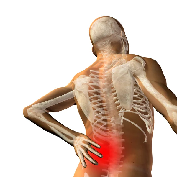 Man anatomy with back pain — Stock Photo, Image