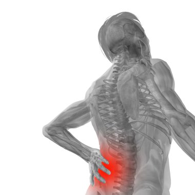 adam anatomisi arka ağrı ile