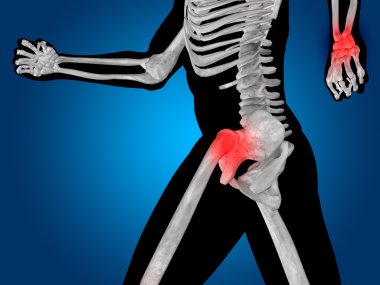 ortak veya eklem ağrısı, ağrı