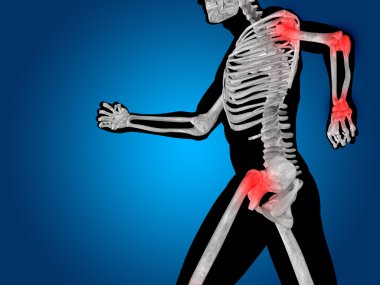 joint or articular pain, ache clipart