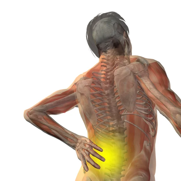 Anatomie člověka s bolestí zad — Stock fotografie