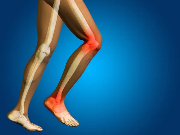 Joint or articular pain, ache — Stock Photo, Image