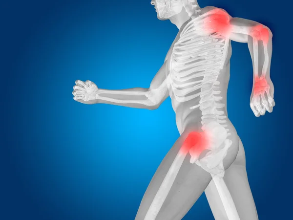 Joint or articular pain, ache — Stock Photo, Image