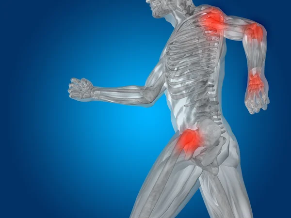 Joint or articular pain, ache — Stock Photo, Image