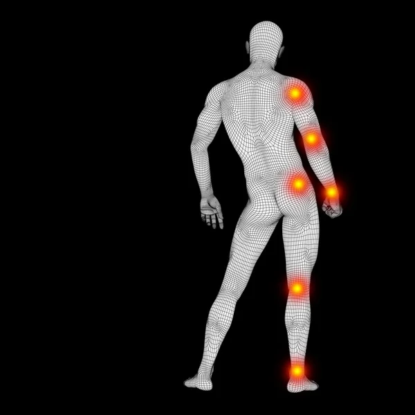 Körper mit Schmerz verknüpfen — Stockfoto