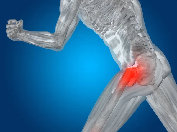 Joint or articular pain, ache — Stock Photo, Image