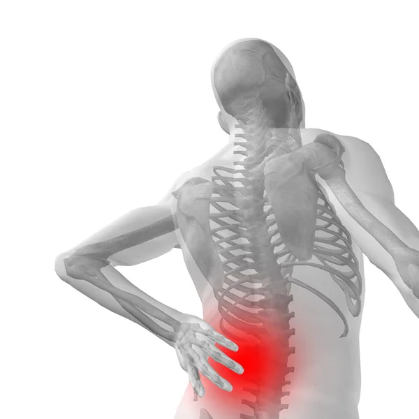 Anatomy with back pain — Stock Photo, Image
