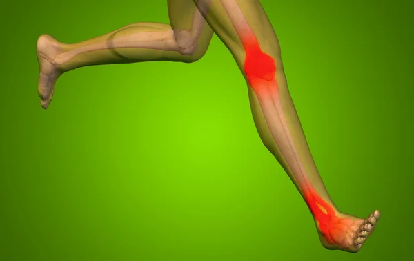 Joint or articular pain, ache — Stock Photo, Image