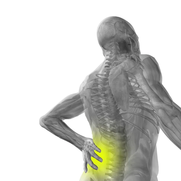 Anatomi manusia dengan nyeri punggung — Stok Foto