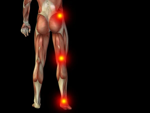 Joint or articular pain, ache — Stock Photo, Image