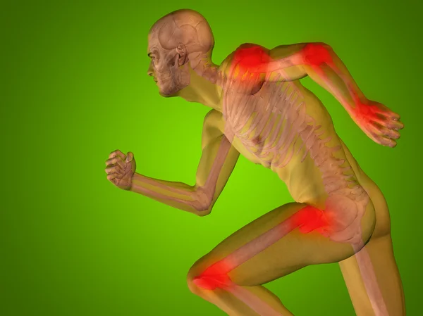 Joint or articular pain, ache — Stock Photo, Image