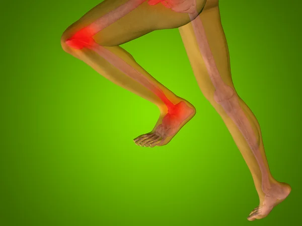 Joint or articular pain, ache — Stock Photo, Image