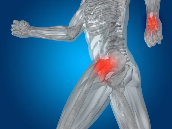 Joint or articular pain, ache — Stock Photo, Image