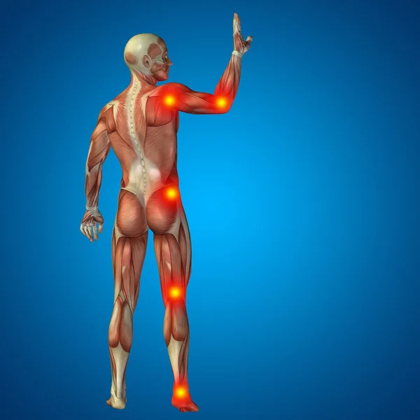 男性のスケルトンの関節や骨の痛み — ストック写真