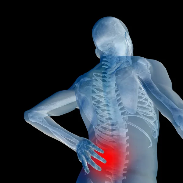 Mężczyzna lub człowieka anatomia z bólu pleców — Zdjęcie stockowe